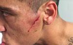 Así quedó la cara del ex del Betis Monzón tras sufrir esta espeluznante brecha
